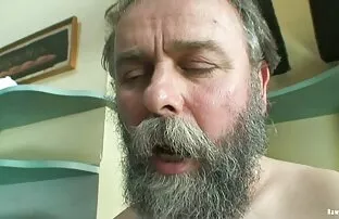 Napaljeni tinejdžer od starca