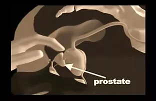 Tehnike masaže prostate