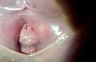 Squirting