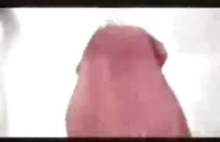 Pakistanski zubarski skandal
