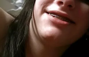 Mladi tinejdžeri sa zagradama